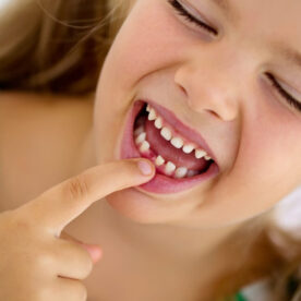 Reversing cavities naturally